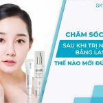CÁCH CHĂM SÓC DA SAU KHI BẮN LASER TRỊ NÁM 7 BƯỚC